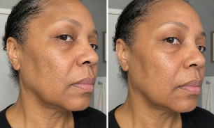 Before and after routine photo for Claire M.