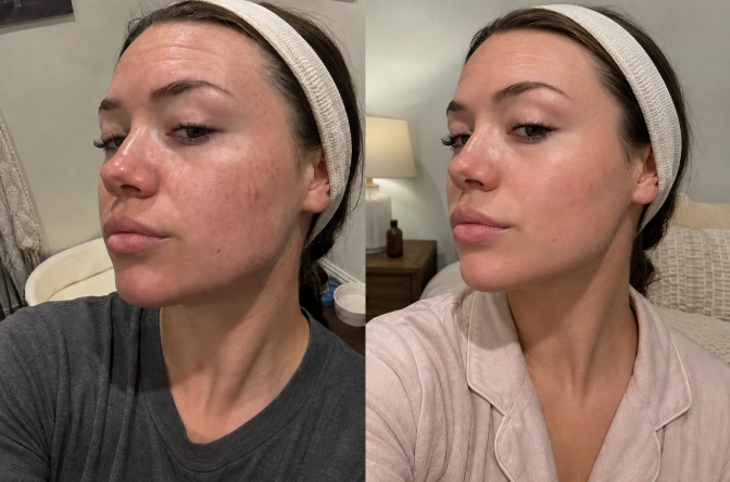 Before and after routine photo for Helen P.