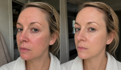 Before and after routine photo for Diana W.