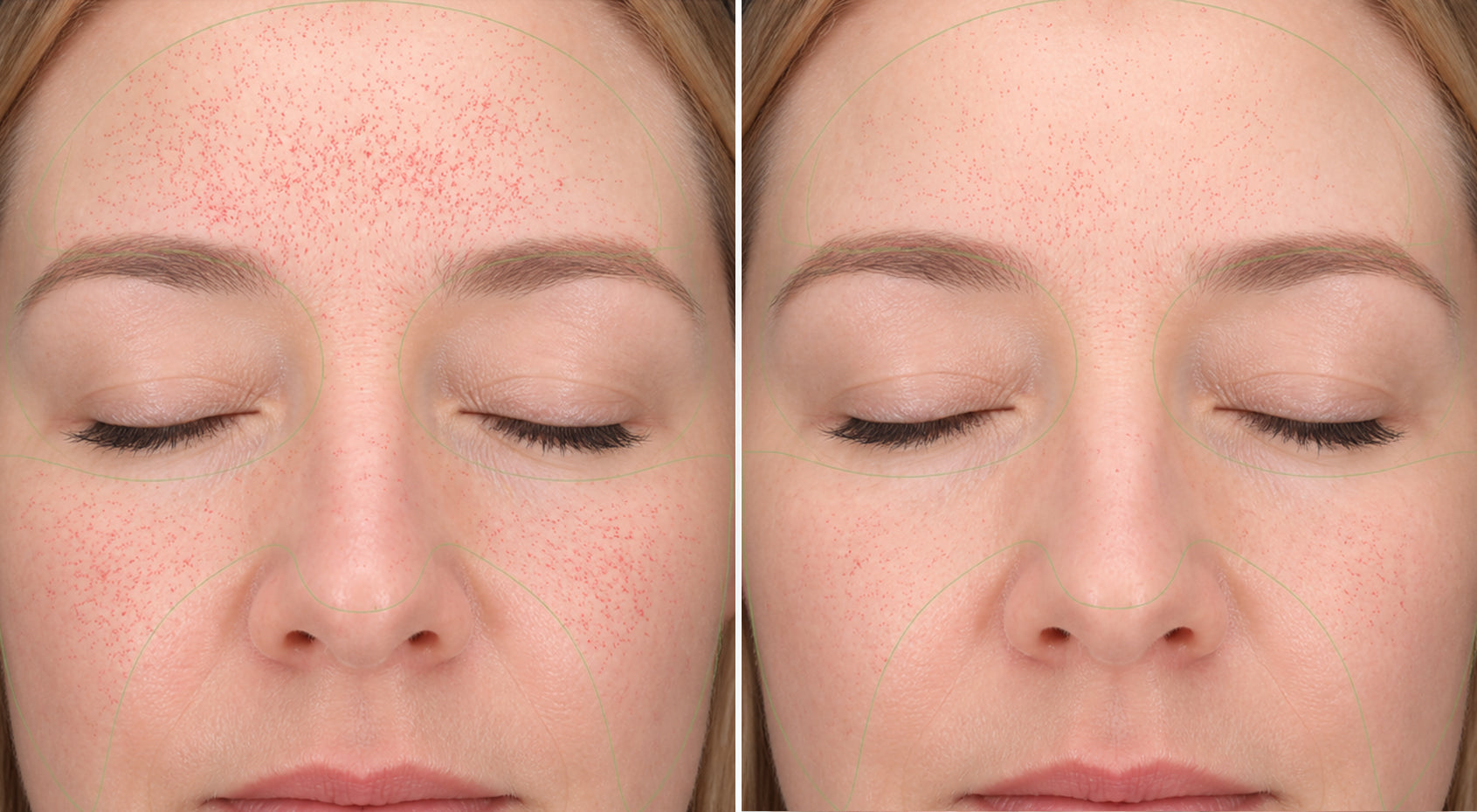 Comparative visual of skin texture and the appearance of fine lines